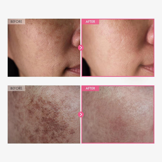 TOSOWOONG Arbutin Tranexamic Cream